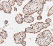 IHC testing of FFPE human placenta tissue with SGPP1 antibody. HIER: steam section in pH9 EDTA for 20 min and allow to cool prior to staining.