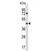 Western blot testing of human NCI-H292 cell lysate with SGPP1 antibody. Predicted molecular weight ~49 kDa.