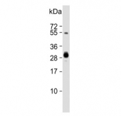 Western blot testing of human Raji cell lysate with HLA-DPB1 antibody. Predicted molecular weight: 29 kDa.