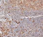 IHC testing of FFPE human lymph node tissue with HLA-DPB1 antibody.