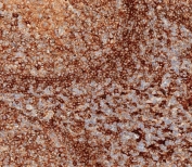 IHC testing of FFPE human tonsil tissue with HLA-DPB1 antibody.