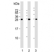 Western blot testing of mouse 1) kidney, 2) stomach and 3) liver lysate with PSCA antibody. Expected molecular weight: 13-29 kDa depending on glycosylation level.