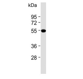 Western blot testing of human WiDr cell lysate with CRTR1 antibody. Predicted molecular weight ~55 kDa.