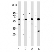 Western blot testing of 1) human kidney, 2) human placenta, 3) mouse kidney and 4) rat kidney lysate with CRTR1 antibody. Predicted molecular weight ~55 kDa.