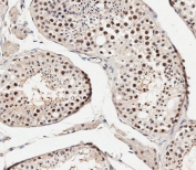IHC testing of FFPE human testis tissue with CRTR1 antibody.