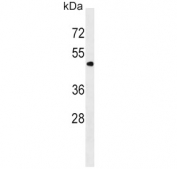 Western blot testing of human K562 cell lysate with PNPLA3 antibody. Predicted molecular weight ~53 kDa.