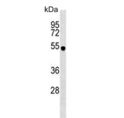 Western blot testing of human MDA-MB-231 lysate with SPNS2 antibody. Predicted molecular weight ~58 kDa.