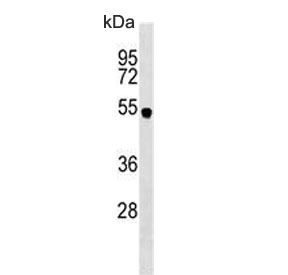 Western blot testing of human MDA-MB-231 lysate with SPNS2 antibody. Predicted molecular weight ~58 kDa.