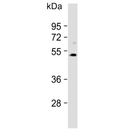Western blot testing of human SK-OV-3 lysate with SPNS2 antibody. Predicted molecular weight ~58 kDa.