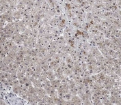 IHC testing of FFPE human liver tissue with SPNS2 antibody. HIER: steam section in pH9 EDTA for 20 min and allow to cool prior to staining.