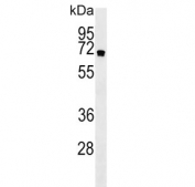 Western blot testing of human NCI-H460 lysate with NCI-H460 antibody. Predicted molecular weight ~68 kDa.