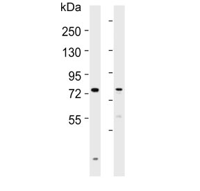 Western blot testing of human 1) liver and 2) ovary lysate with SLCO1B3 antibody. Expected molecular weight: 77-120 kDa depending on glycosylation level.~
