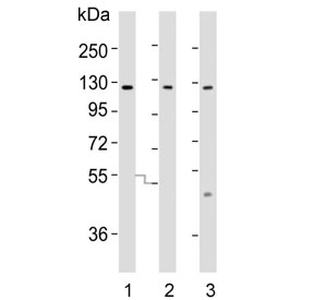 Western blot testing of human 1) HeLa, 2) PC-3 and 3) SW480 lysate with SLCO1B3
