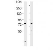 Western blot testing of human 1) liver and 2) ovary lysate with SLCO1B3 antibody. Expected molecular weight: 77-120 kDa depending on glycosylation level.