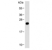 Western blot testing of human placenta lysate with NGN3 antibody. Predicted molecular weight ~23 kDa.