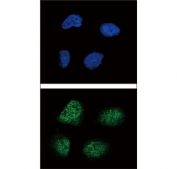 Immunofluorescent staining of fixed and permeabilized human NCI-H460 cells with NGN3 antibody (green) and DAPI nuclear stain (blue).