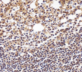 IHC testing of FFPE human tonsil tissue with HLA-B antibody. HIER: steam section in pH6 citrate buffer for 20 min and allow to cool prior to staining.