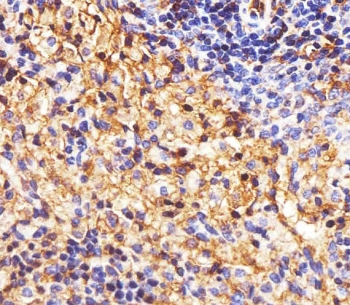IHC testing of FFPE rat spleen tissue with HLA-B antibody. HIER: steam section in pH6 citrate buffer for 20 min and allow to cool prior to staining.