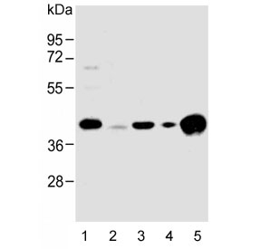 Western blot testing of human 1) HeLa, 2) HL60, 3) Jurkat, 4) Ramos and 5) spleen lysate with HLA-B antibody. Predicted molecular weight: ~40/45 kDa (unmodified/glycosylated).