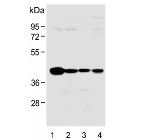Western blot testing of human 1) HeLa, 2) HL60, 3) A549 and 4) Jurkat lysate with HLA-B antibody. Predicted molecular weight: ~40/45 kDa (unmodified/glycosylated).