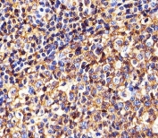 IHC testing of FFPE human tonsil tissue with HLA-B antibody. HIER: steam section in pH6 citrate buffer for 20 min and allow to cool prior to staining.