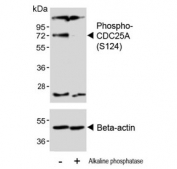 Western blot testing of lysate from human 293 cells untreated or treated with alkaline phosphatase using phospho-CDC25A antibody. Predicted molecular weight: 59-70 kDa.