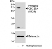 Western blot testing of lysate from human A2780 cells untreated or treated with alkaline phosphatase using phospho-CDC25A antibody. Predicted molecular weight: 59-70 kDa.