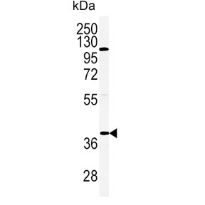 Western blot testing of human HeLa cell lysate with Adiponectin Receptor 2 antibody. Predicted molecular weight ~44 kDa.