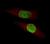 Immunofluorescent staining of fixed and permeabilized human U-251 MG cells with USP17L24 antibody (green) and anti-Actin (red).