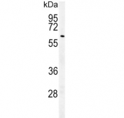 Western blot testing of human HepG2 cell lysate with USP17L24 antibody. Predicted molecular weight ~60 kDa.