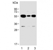Western blot testing of human 1) U-87 MG, 2) MDA-MB-231 and 3) U-251 MG cell lysate with USP17L24 antibody. Predicted molecular weight ~60 kDa.