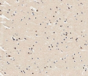 IHC testing of FFPE human brain tissue with USP17L24 antibody. HIER: steam section in pH6 citrate buffer for 20 min and allow to cool prior to staining.