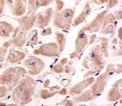 IHC testing of FFPE human heart tissue with VLDL Receptor antibody. HIER: steam section in pH6 citrate buffer for 20 min and allow to cool prior to staining.