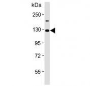 Western blot testing of human 293T cell lysate with VLDL Receptor antibody. Expected molecular weight: 96-160 kDa depending on glycosylation level.