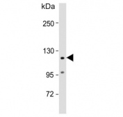 Western blot testing of human heart lysate with VLDL Receptor antibody. Expected molecular weight: 96-160 kDa depending on glycosylation level.