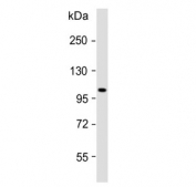 Western blot testing of human skeletal muscle lysate with ATP1A2 antibody. Predicted molecular weight ~112 kDa.