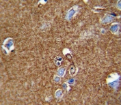 IHC testing of FFPE human brain tissue with ATP1A2 antibody. HIER: steam section in pH6 citrate buffer for 20 min and allow to cool prior to staining.