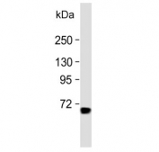 Western blot testing of mouse colon lysates with ESRP1 antibody. Predicted molecular weight: 57-76 kDa (multiple isoforms).