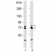 Western blot testing of human 1) A431 and 2) MCF7 cell lysates with ESRP1 antibody. Predicted molecular weight: 68-76 kDa (multiple isoforms).