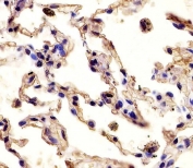 IHC testing of FFPE human lung tissue with MMP12 antibody. HIER: steam section in pH6 citrate buffer for 20 min and allow to cool prior to staining.