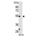 Western blot testing of mouse kidney lysate with MMP12 antibody in the absence and presence of blocking peptide. Predicted molecular weight: ~55 kDa.