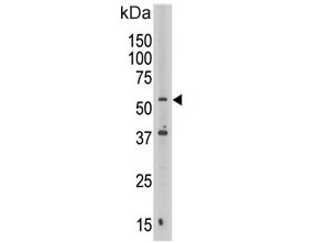 Western blot testing of human Jurkat lysate with Septin 9 antibody. Predicted molecular weight: 63-65 kDa (multiple isoforms).