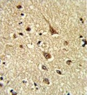 IHC testing of FFPE human brain tissue with Glyoxalase I antibody. HIER: steam section in pH6 citrate buffer for 20 min and allow to cool prior to staining.