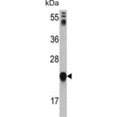 Western blot testing of human HL60 cell lysate with Glyoxalase I antibody. Predicted molecular weight ~21 kDa.