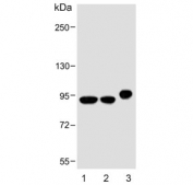Western blot testing of 1) human HepG2, 2) human HT-29 and 3) mouse kidney lysate with VIL1 antibody. Predicted molecular weight ~93 kDa.