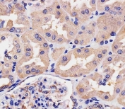 IHC testing of FFPE human kidney tissue with VIL1 antibody. HIER: steam section in pH6 citrate buffer for 20 min and allow to cool prior to staining.