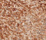IHC testing of FFPE human liver tissue with Glucagon antibody. HIER: steam section in pH9 EDTA for 20 min and allow to cool prior to staining.