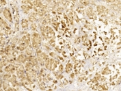 IHC testing of FFPE human pancreas tissue with Glucagon antibody. HIER: steam section in pH6 citrate buffer for 20 min and allow to cool prior to staining.