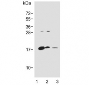 Western blot testing of human 1) PANC1, 2) brain and 3) Jurkat lysate with Glucagon antibody. Predicted molecular weight ~21 kDa (pro form).