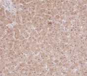 IHC testing of FFPE human liver tissue with RPS18 antibody. HIER: steam section in pH9 EDTA for 20 min and allow to cool prior to staining.